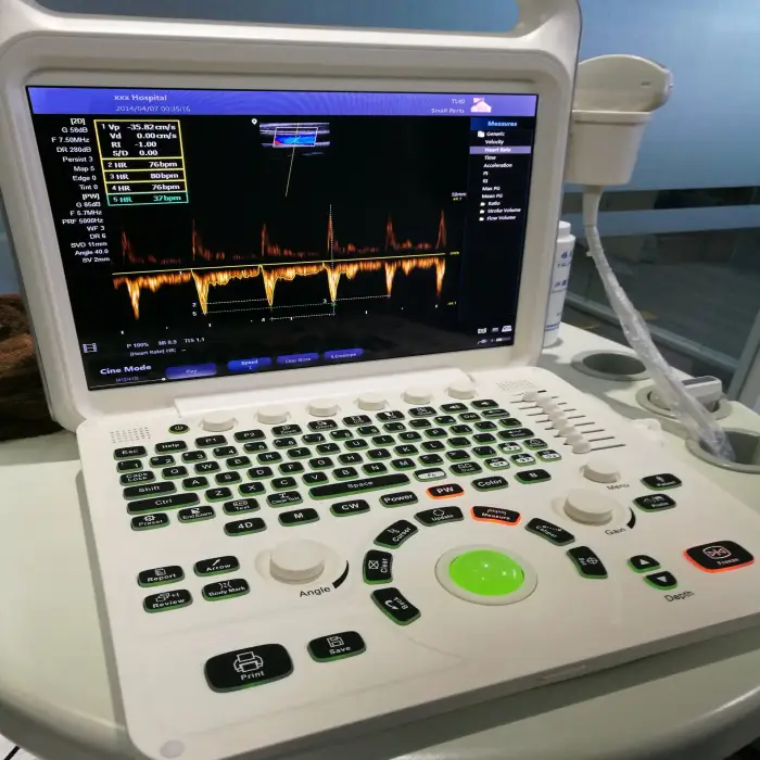 Chenwei Veterinary Medical Ultrasound Instruments Portable 3d 4D Color Doppler Laptop Ultrasound Machine for hospital