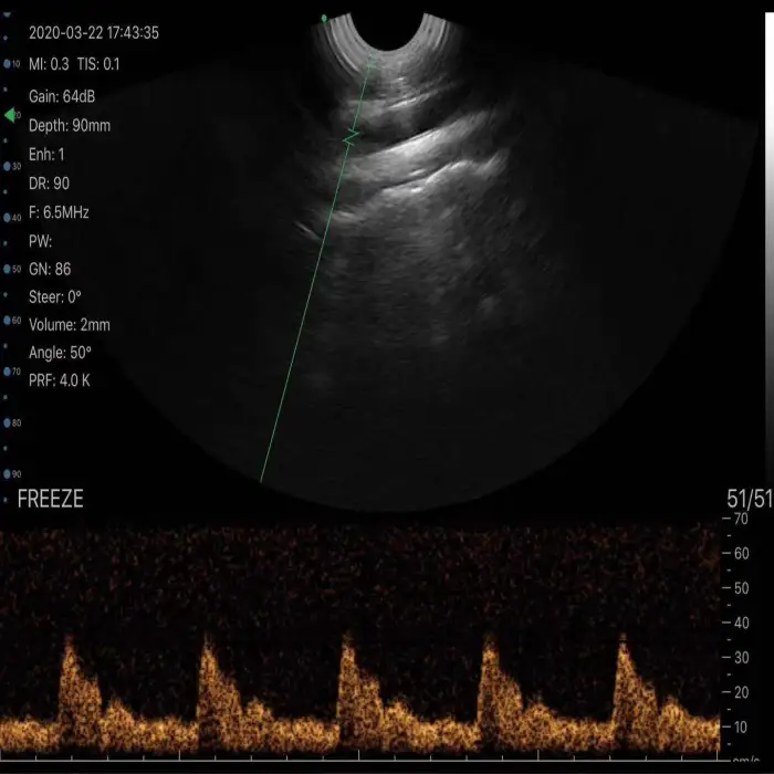 SY-AVL_vet  Portable Veterinary sonar Big Animal transrectal series wireless probe type ultrasound scanner