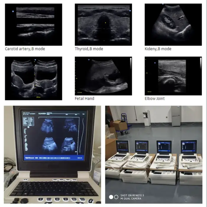 SUN-806H Portable Sonar ultrasonic for Pregnant humans