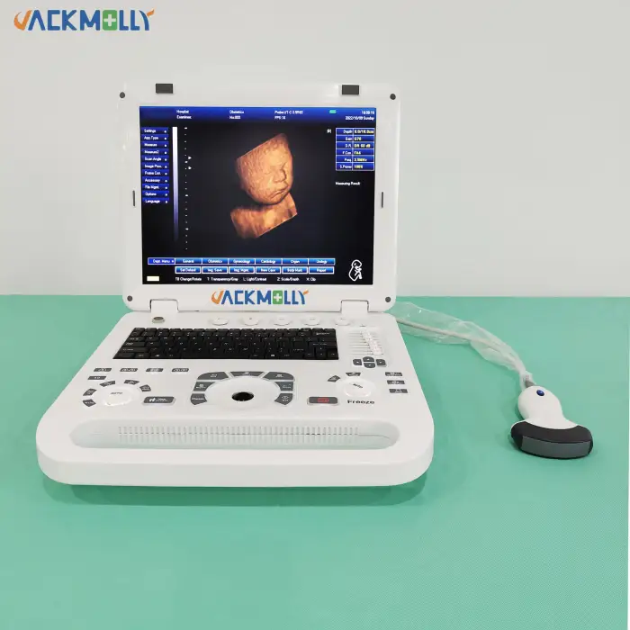 JM-800D Medical 15 Inch Screen Portable Sonar ultrasonic with rectal probe For Veterinary