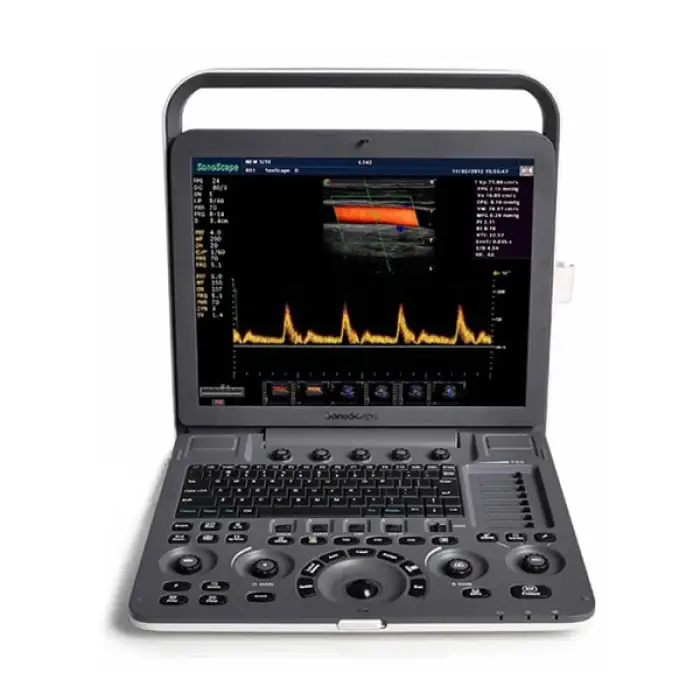 Portable Color Doppler Ultrasound S9  Pro diagnomicall medical ultrasound scanner machine