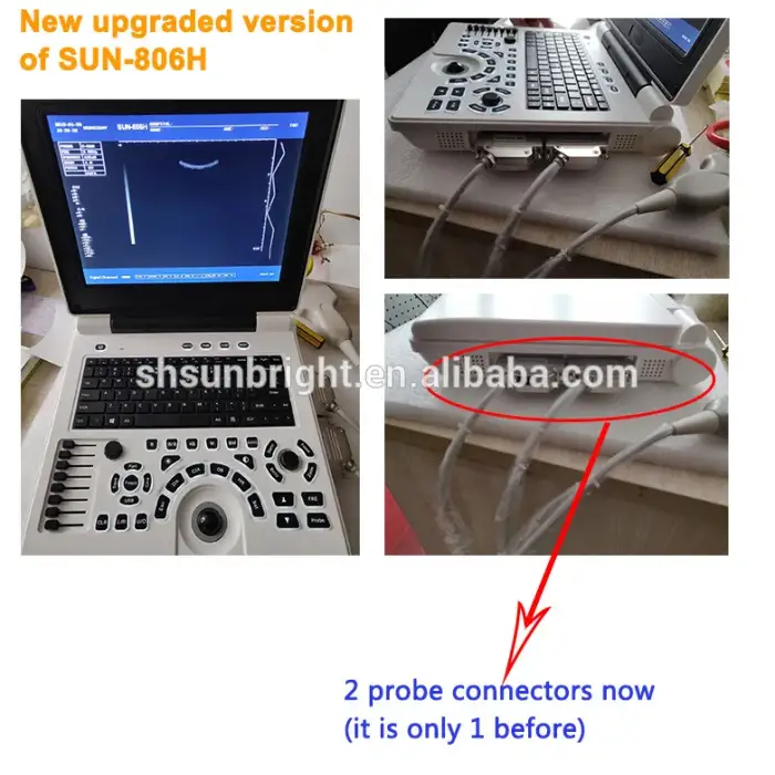 medical use sonography machine portable ultrasound sonar