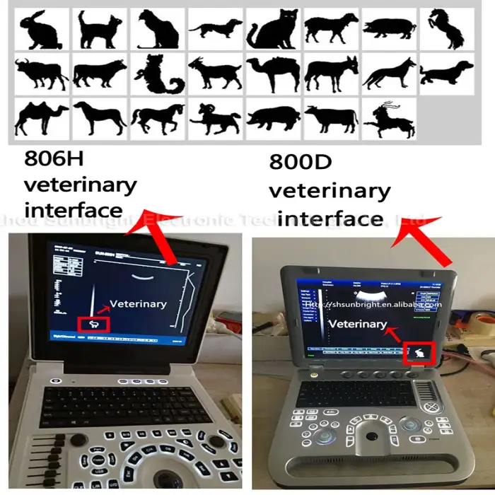 medical use sonography machine portable ultrasound sonar