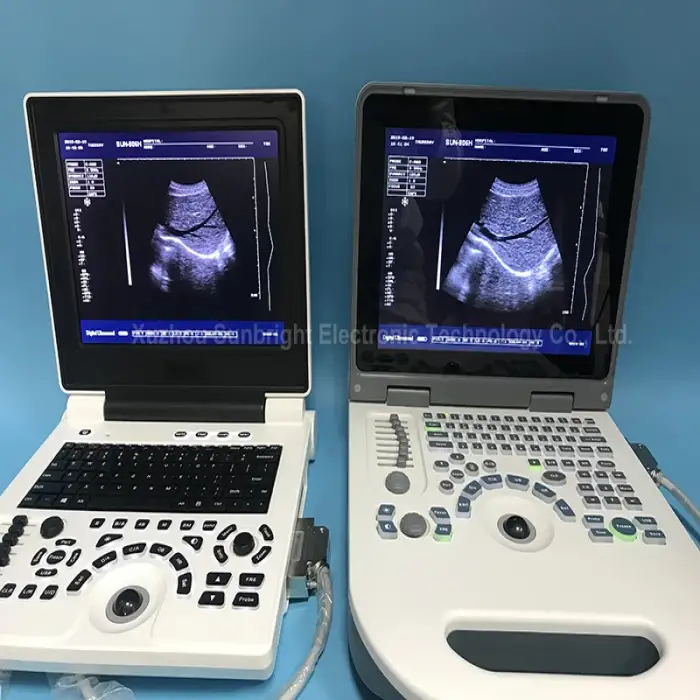 medical use sonography machine portable ultrasound sonar