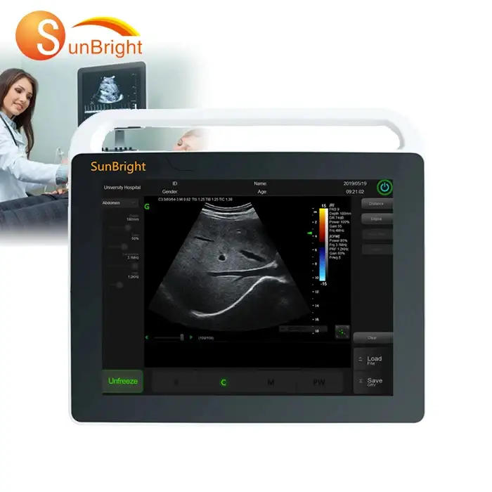 High resolution SunBright medical SUN-800S portable 15 inch Ultrasound machine