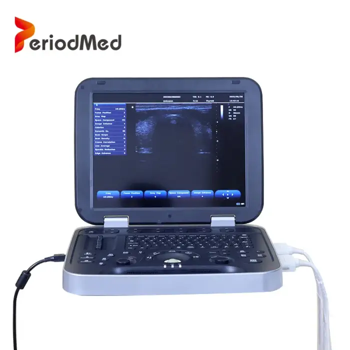 Periodmed medical equipment ultrasound machines abdominal machine cardiology colour transvaginal scan ultrasound