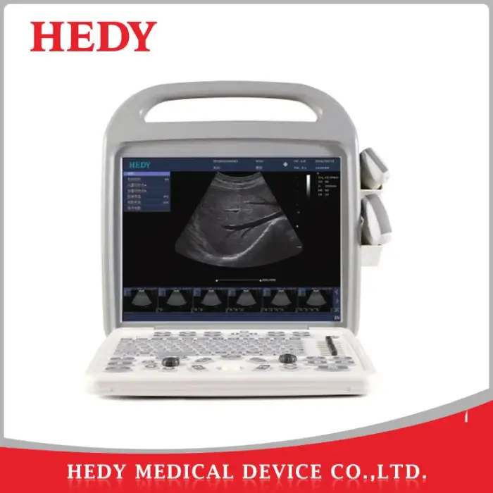 2D 3D 4D Portable Color Ultrasound Machine Price Scanner