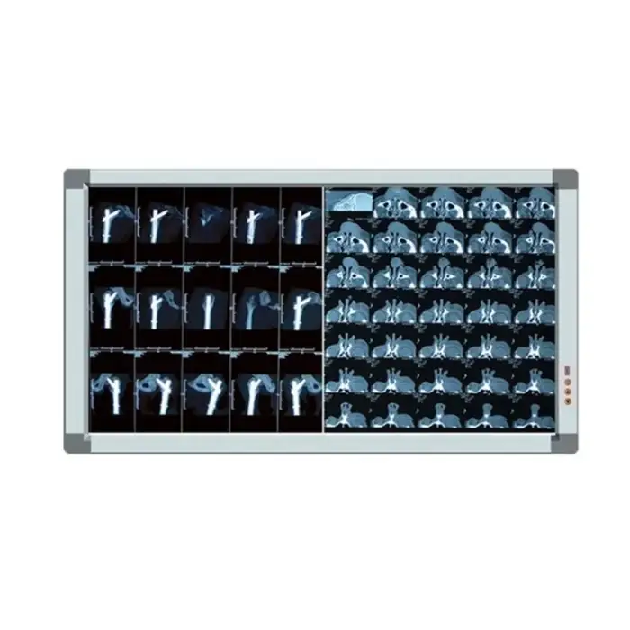 Excellent OM-2PLA Medical X-ray Film Negatoscope LED X ray Film Viewing Box Radiology Film Viewer