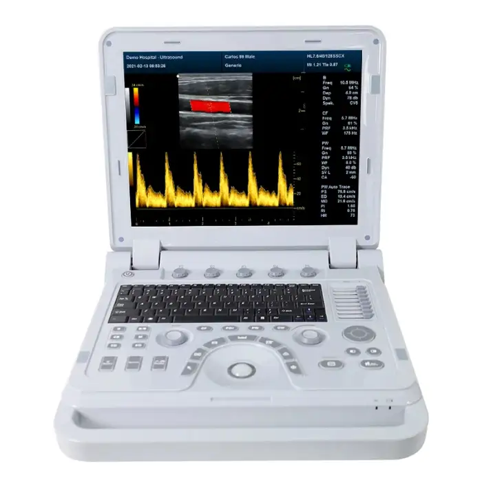 CONTEC CMS1700B Color Doppler USG Color Ultrasound Scanner Diagnostic Machine Systems Convex Probe