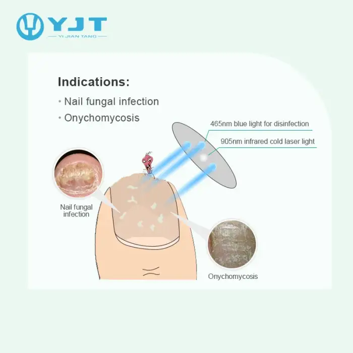 Laser Treatment Instrument for Nail Infection and Fungus Physical Therapy Equipment