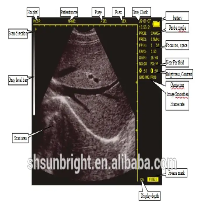 Hand held 5.6 inch veterinary medical Ultrasound Diagnostic equipment