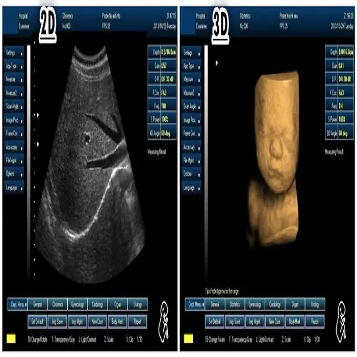 laptop 15 inches ultrasound