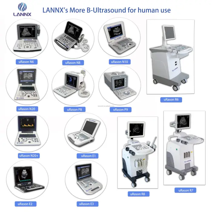 LANNX uRason N6 Medical Ultrasound Instruments