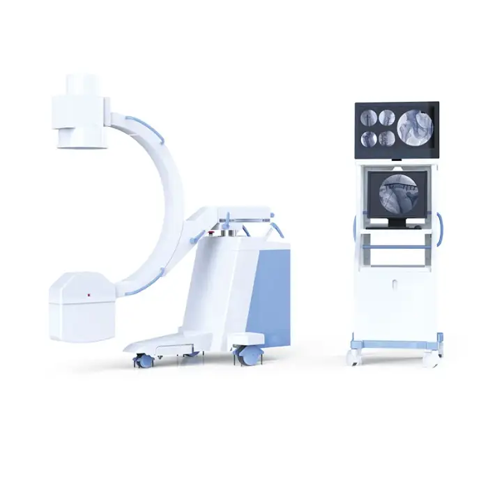 Mobile C-arm X-ray Machine System – Portable Medical Radiology Equipment with High Resolution Imaging