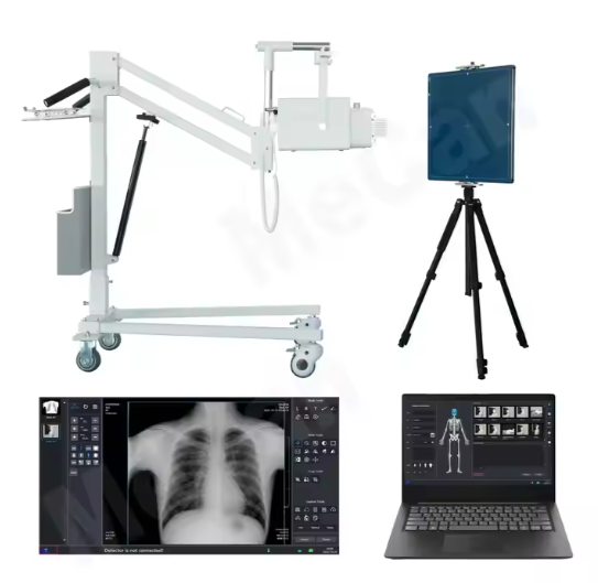 Portable Digital X-ray Machine Medical Scanner System