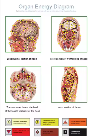 High Energy CT Scanner MRI Computer Tomography Organ Cells DNA Scanning Machine