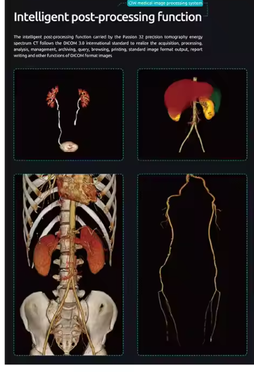 24 32 Slice Medical Computed Tomography CT Scanner Machine for Hospital