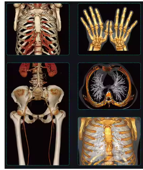 24 32 Slice Medical Computed Tomography CT Scanner Machine for Hospital