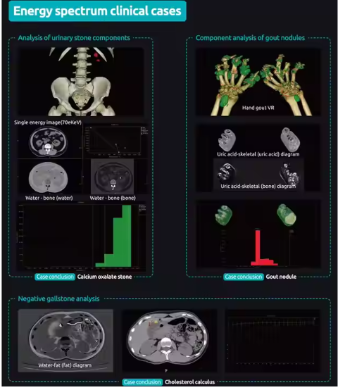 24 32 Slice Medical Computed Tomography CT Scanner Machine for Hospital