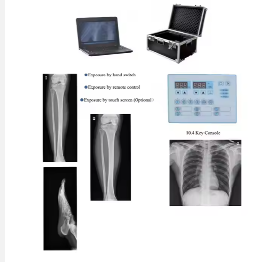 Multifunctional Digital X-Ray Machine Medical Imaging Scanner