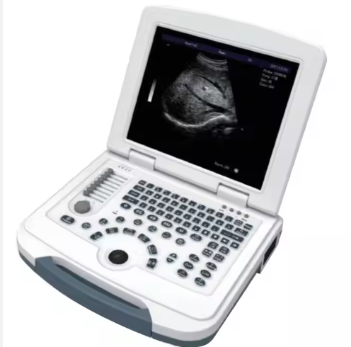 Physical Therapy Ultrasound Scanner Therapeutic Ultrasound Machine Diagnosis Probe Laptop Ultrasound