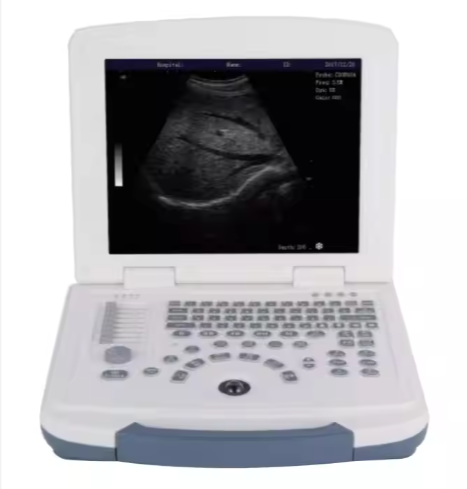 Physical Therapy Ultrasound Scanner Therapeutic Ultrasound Machine Diagnosis Probe Laptop Ultrasound