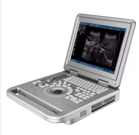 Advanced Portable Full Digital B/W Ultrasound Scanner Diagnostic Medical Equipment Machine