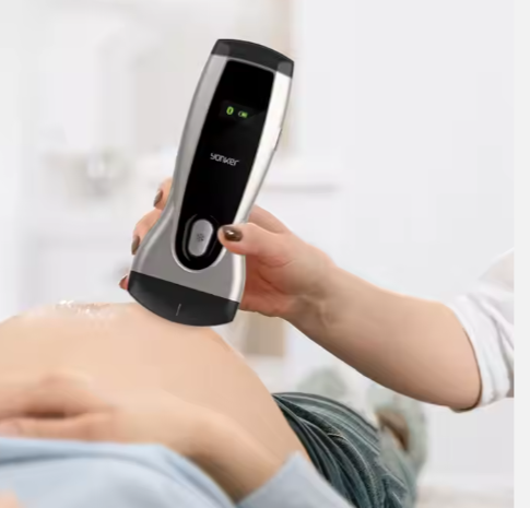 Handheld USB WiFi Color Doppler Ultrasound Scanner Portable Wireless Medical Ultrasound Probe Machine