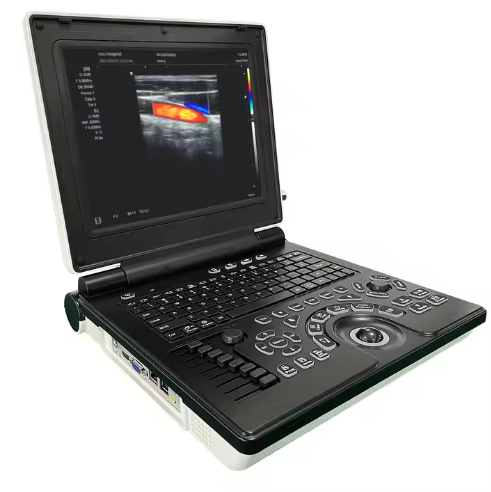 Portable Color Doppler Ultrasonic Laptop Ultrasound Scanner Medical Diagnostic Device