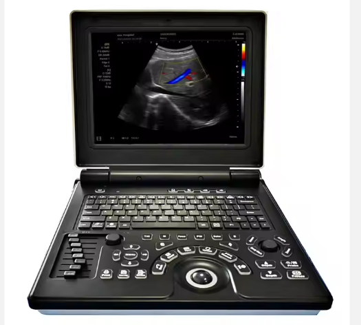 Portable Color Doppler Ultrasonic Laptop Ultrasound Scanner Medical Diagnostic Device