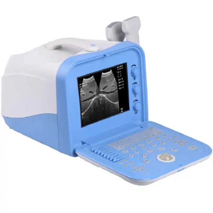 Advanced Portable Ultrasound Machine For Reliable Diagnostic Imaging In Medical Practice Device