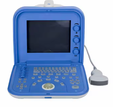 Advanced Portable Ultrasound Machine For Reliable Diagnostic Imaging In Medical Practice Device