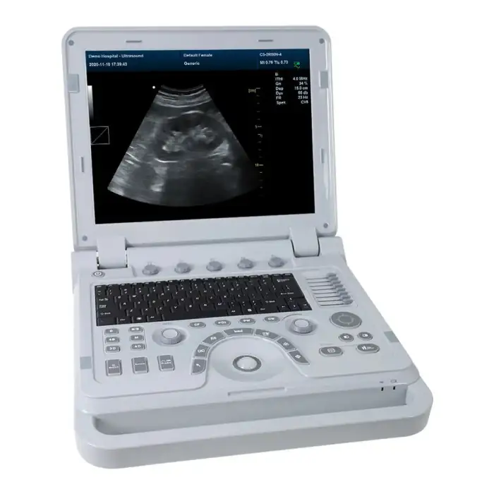 Advanced Portable Ultrasound Scanner For Human Being User-Friendly Medical Device