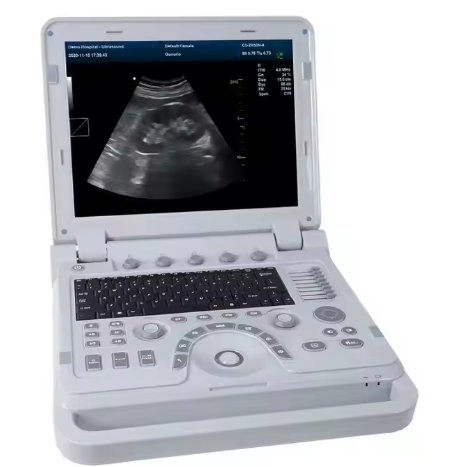 Advanced Portable Ultrasound Scanner For Human Being User-Friendly Medical Device