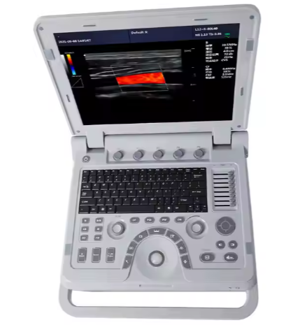 Advanced Portable Ultrasound Scanner For Human Being User-Friendly Medical Device