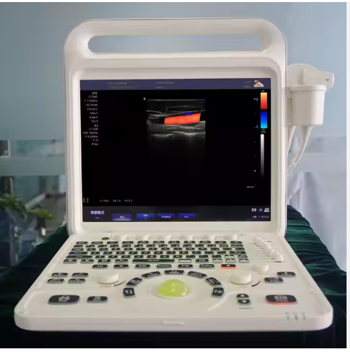 Advanced Imaging Technique With LED Screen Medical Ultrasound 4D Portable Device