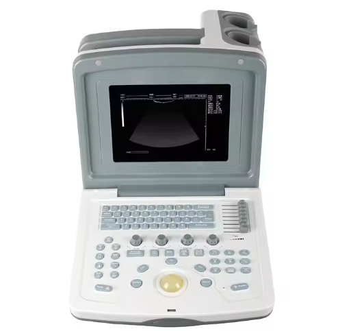 Portable Ultrasound Scanner Medical Equipment Hospital Ultrasound Diagnostic Machine