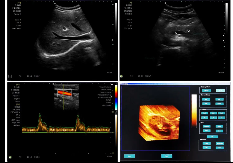 Reliable Ultrasound Machine Advanced Portable Ultrasound Diagnostic Scanner Medical Device