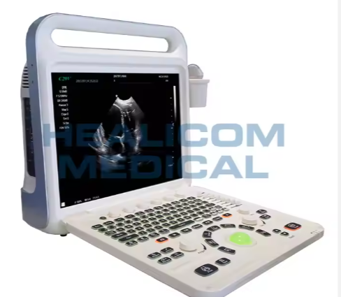 Advanced Portable Ultrasound Scanner Diagnostic Instrument