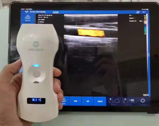 Advanced Portable Wireless Sonography 192 Elements Handheld High Frequency Linear Ultrasound Probe