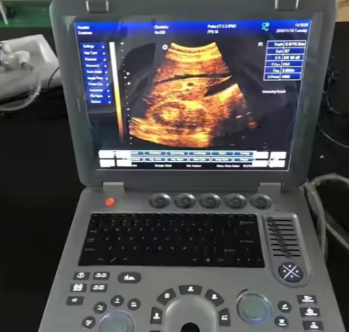 Portable 3D 4D Echo Ultrasound Machine Cost Effective Human Ultrasound