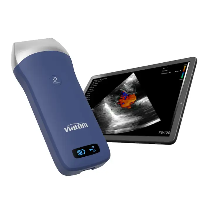 Viatom Wireless Ultrasound Linear Handheld Ultrasound Portable Scanner 250 Gram Device