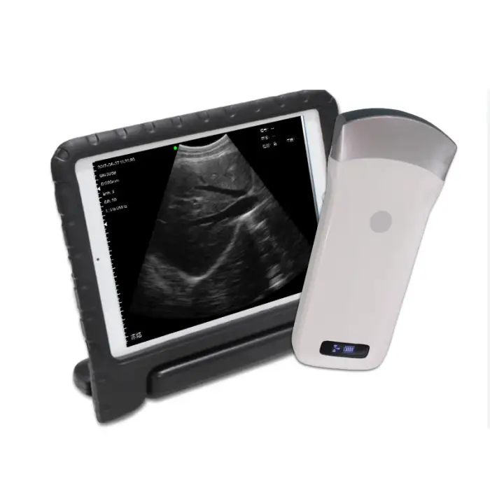 Portable Smartphone Convex Phased Array Ultrasound Scanner Imaging Device Solution