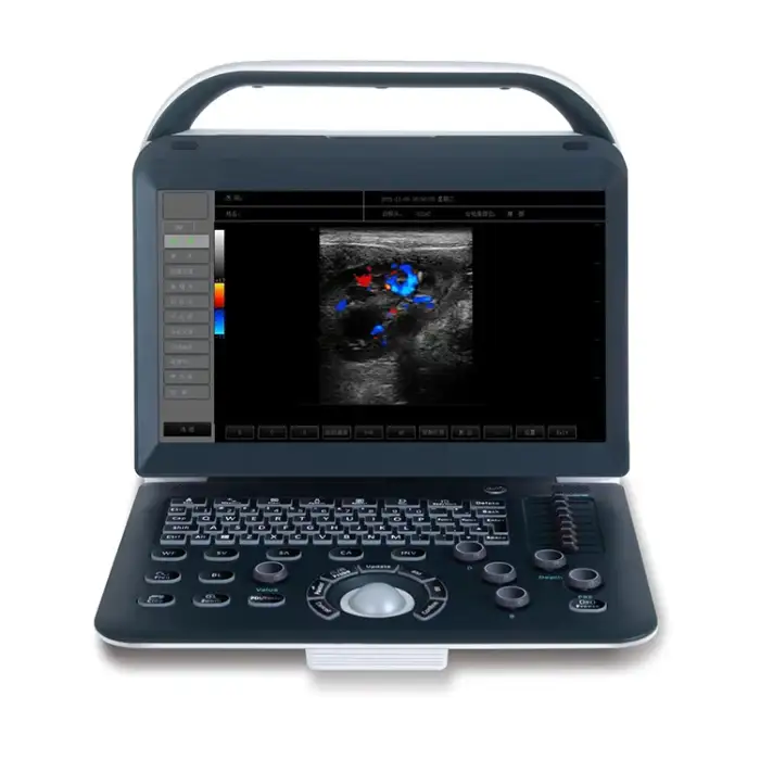 Clearer Image Portable Color Diagnostic Ultrasound Scanner Cost-Effective Imaging Solution