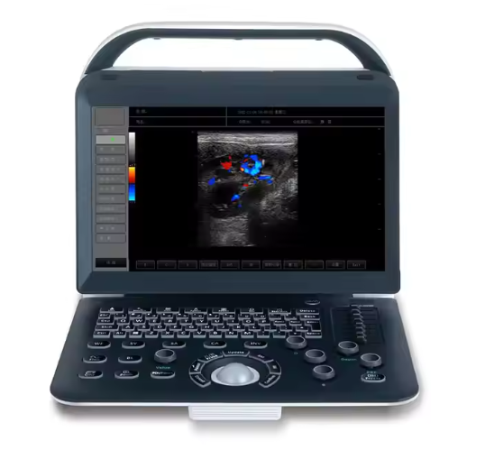 Clearer Image Portable Color Diagnostic Ultrasound Scanner Cost-Effective Imaging Solution