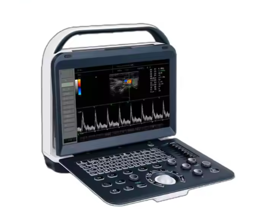 Clearer Image Portable Color Diagnostic Ultrasound Scanner Cost-Effective Imaging Solution