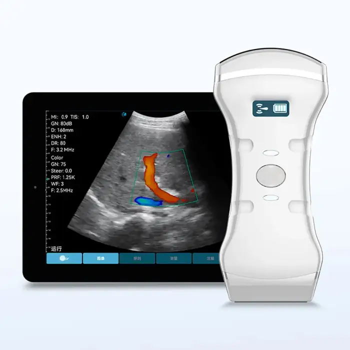 Portable Handheld Convex Linear Cardiac 3 In 1 Wireless Ultrasound Probe