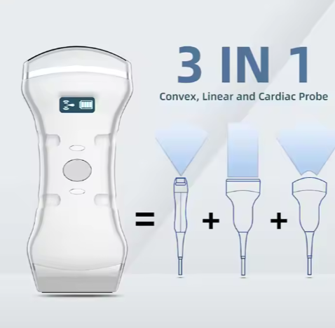 Portable Handheld Convex Linear Cardiac 3 In 1 Wireless Ultrasound Probe