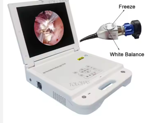 Portable Monitor With LED Light ENT CCD Medical Endoscope Portable Endoscope Camera