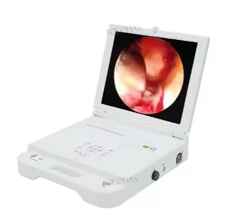 Portable Monitor With LED Light ENT CCD Medical Endoscope Portable Endoscope Camera